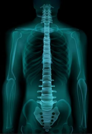 Orthopedic